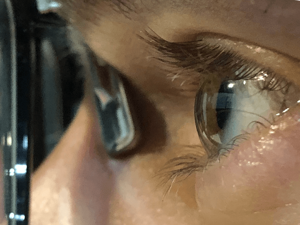 Close-up of an eye behind glasses with a nose-pad electrode